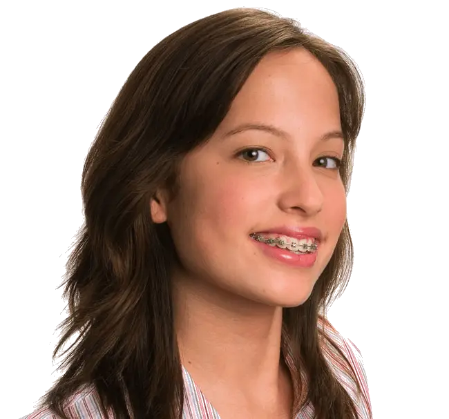 Selbstligierende Brackets digital geplant