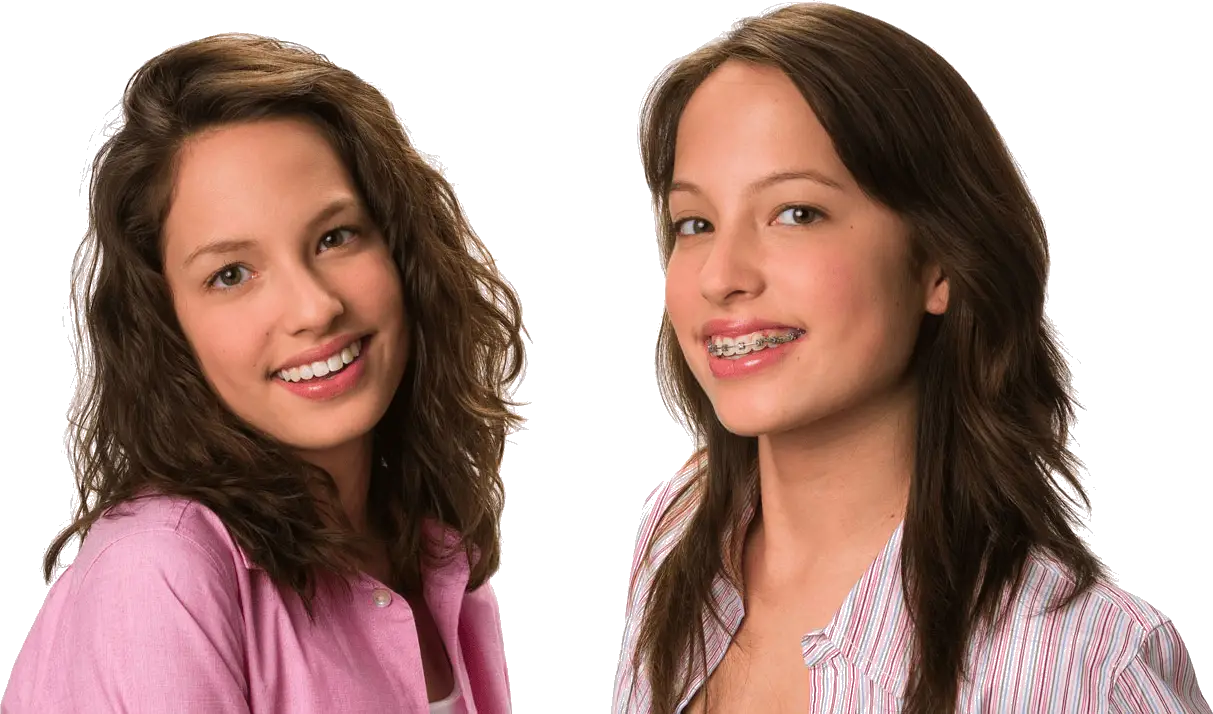 Selbstligierende Brackets digital geplant